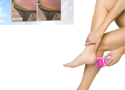 EMSON LAURANT PERSONAL PEDI